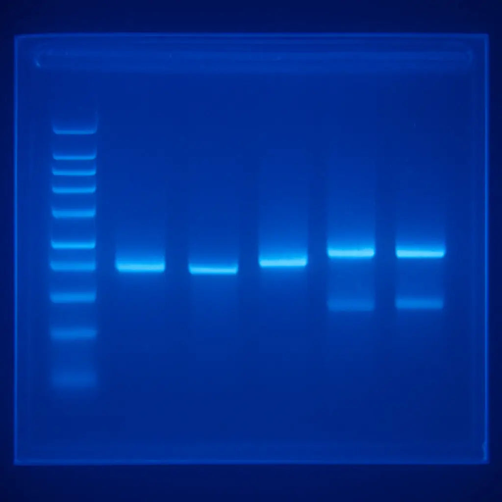 A high‑resolution agarose gel with clear, sharp bands under a blue light transilluminator. Alt: Gel electrophoresis ready for imaging, showing ladder and sample lanes.