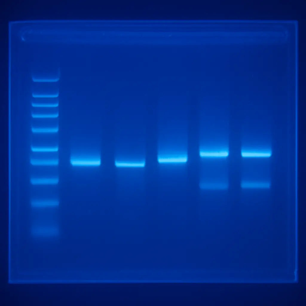 A high‑resolution agarose gel with clear, sharp bands under a blue light transilluminator. Alt: Gel electrophoresis ready for imaging, showing ladder and sample lanes.